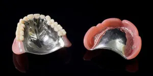 熊本市東区長嶺南のすけひろ歯科・kidsデンタルクリニック 入れ歯(金属床義歯)