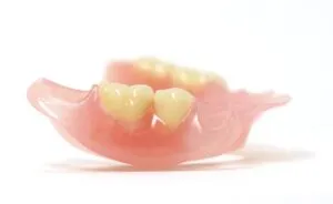 熊本市東区長嶺南のすけひろ歯科・kidsデンタルクリニック 入れ歯(ノンクラスプデンチャー)