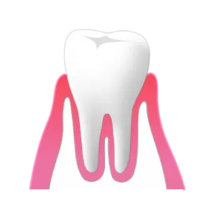 熊本市東区長嶺南のすけひろ歯科kidsデンタルクリニック 歯健康な状態